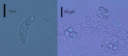 : Myxozoa.