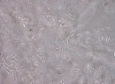 : Barbatosphaeria barbirostris.