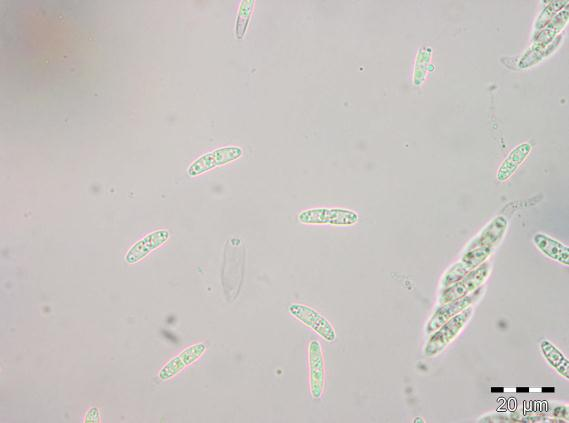 : Diaporthella aristata.