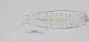 : Echinoderes setiger.