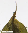 : Syntrichia papillosa.