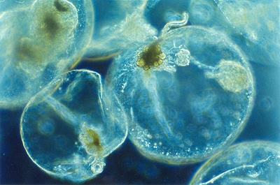 : Noctiluca scintillans.