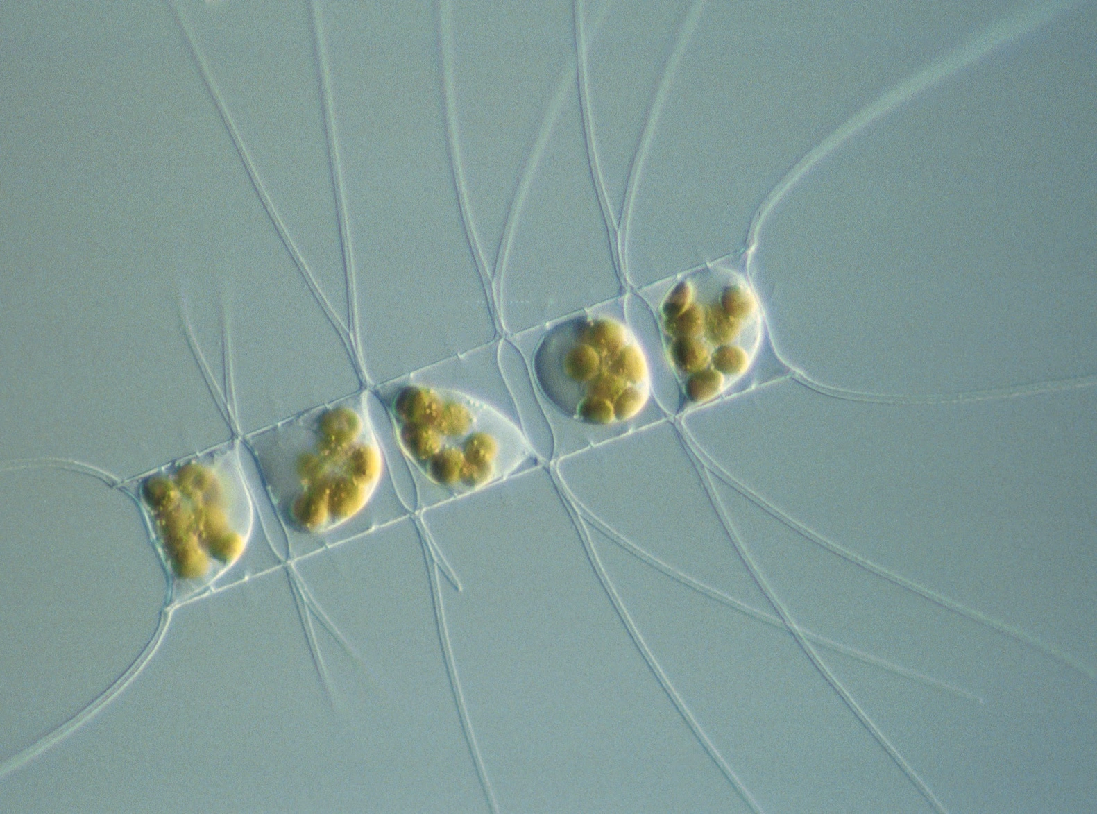 : Chaetoceros (Hyalochaete) decipiens.