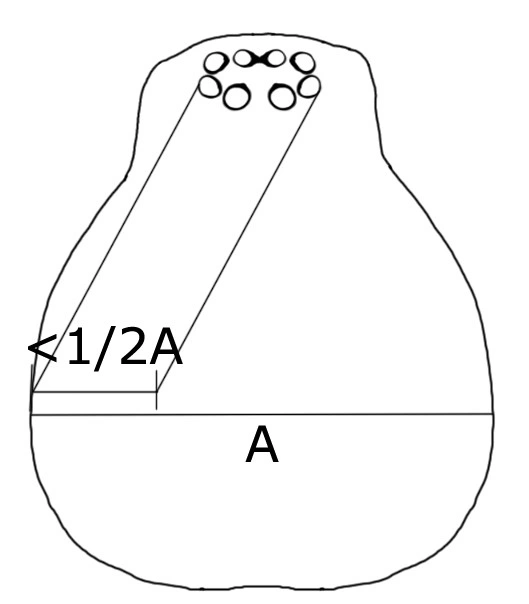 : Liocranidae.