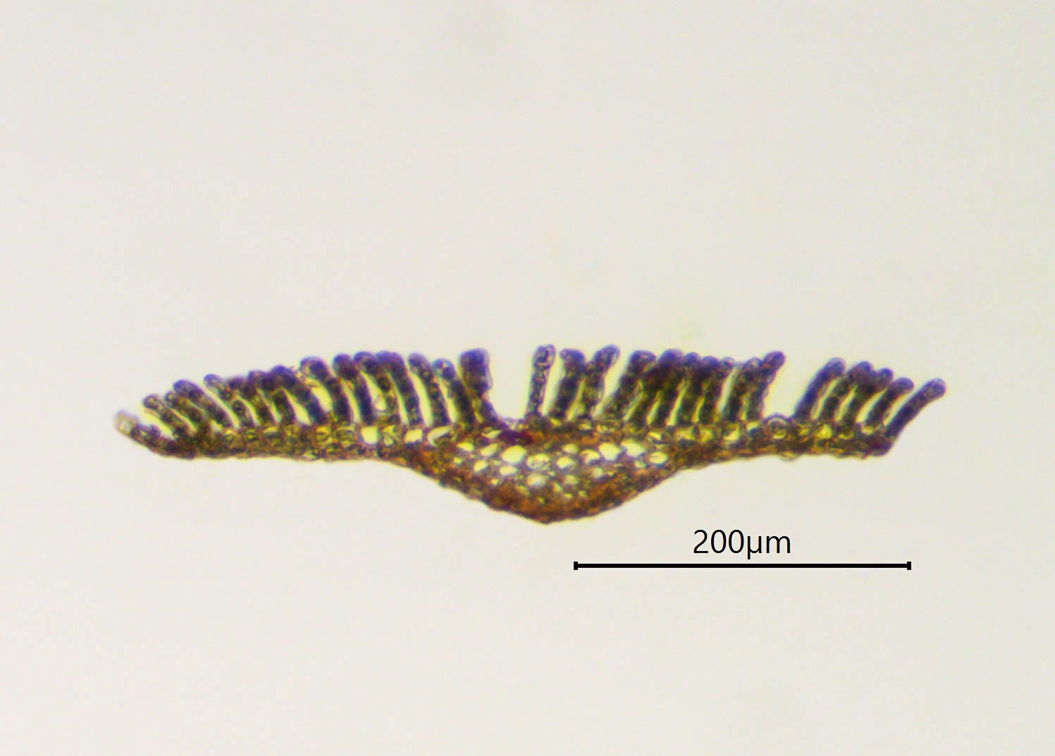 : Polytrichum pallidisetum.