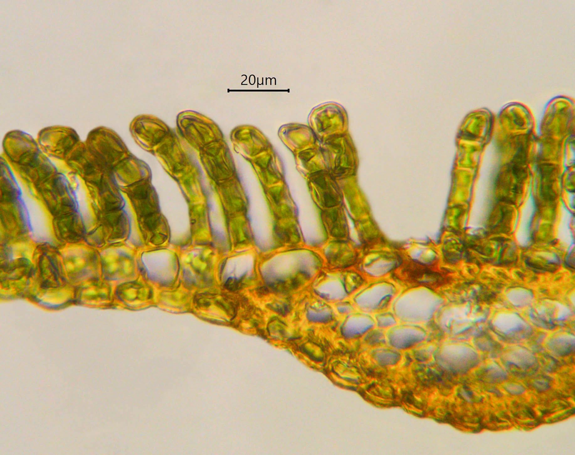 : Polytrichum pallidisetum.