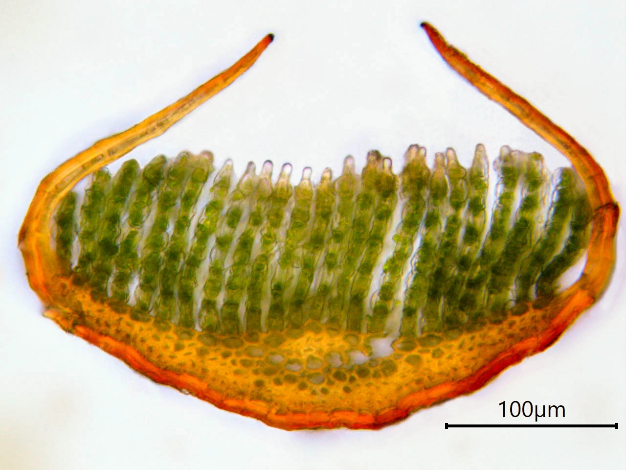 : Polytrichum piliferum.