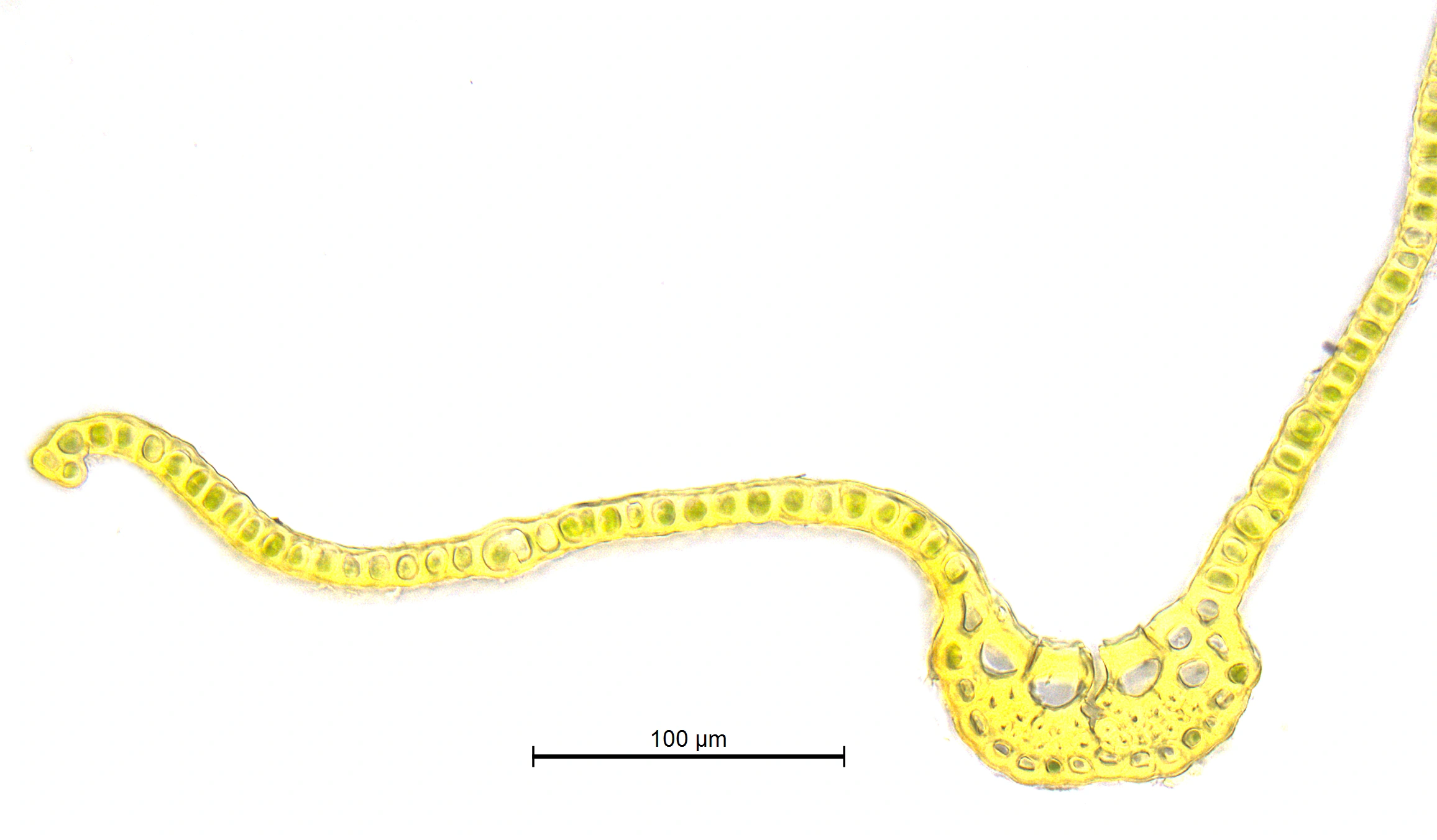 : Grimmia hartmanii.