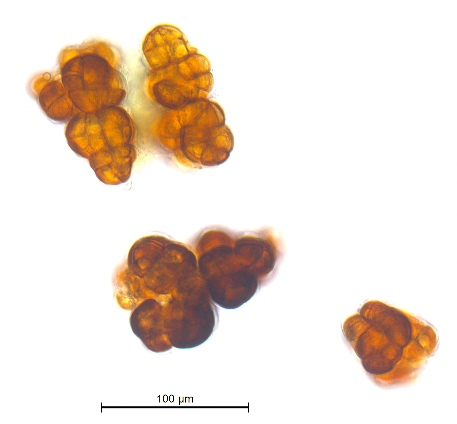 : Grimmia torquata.