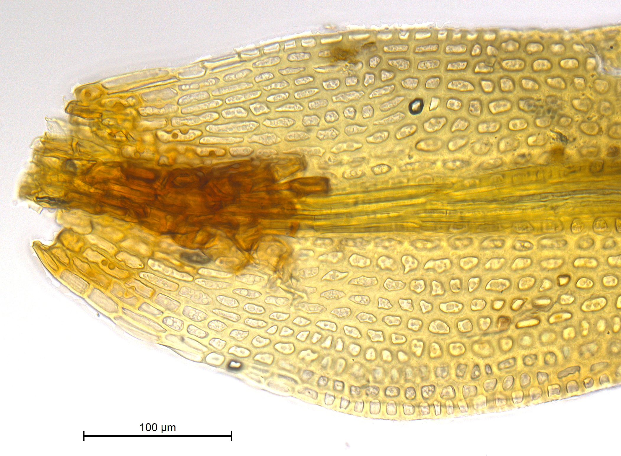 : Grimmia torquata.