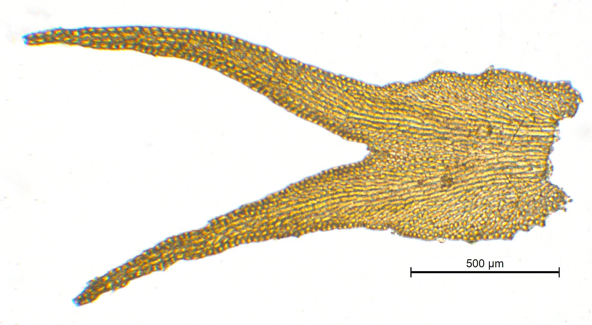 : Herbertus hutchinsiae.