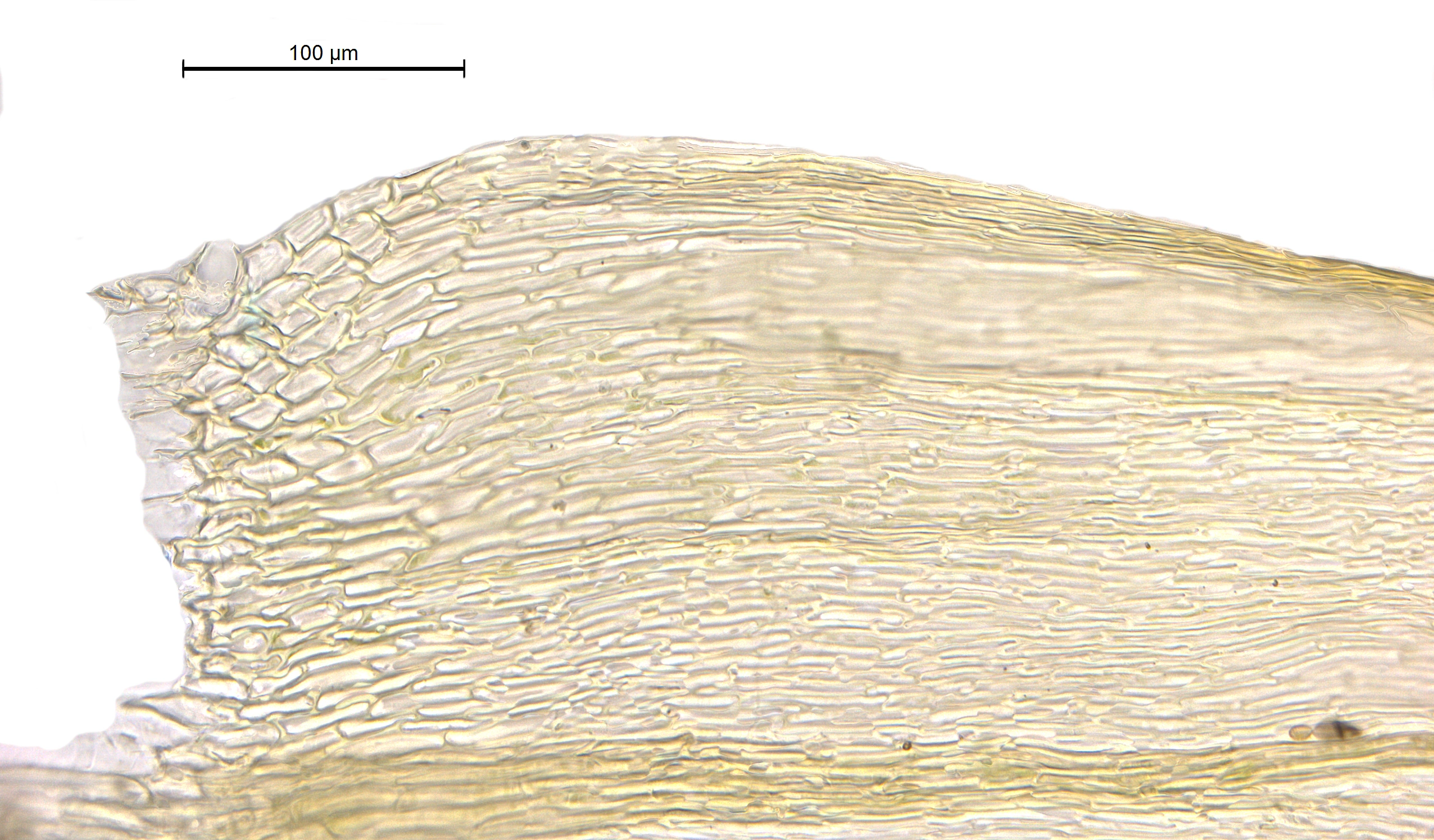 : Brachytheciastrum collinum.