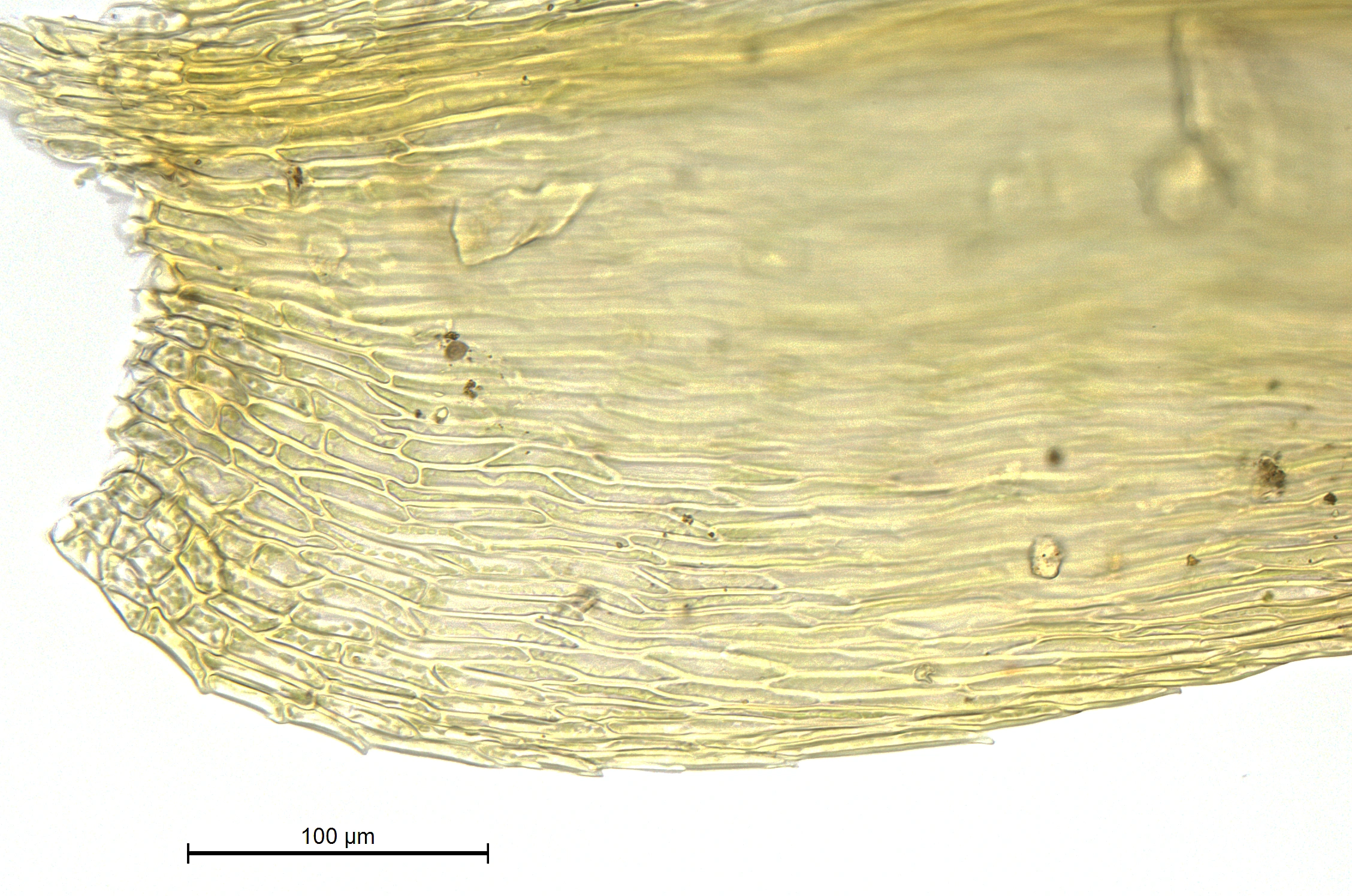 : Brachytheciastrum trachypodium.