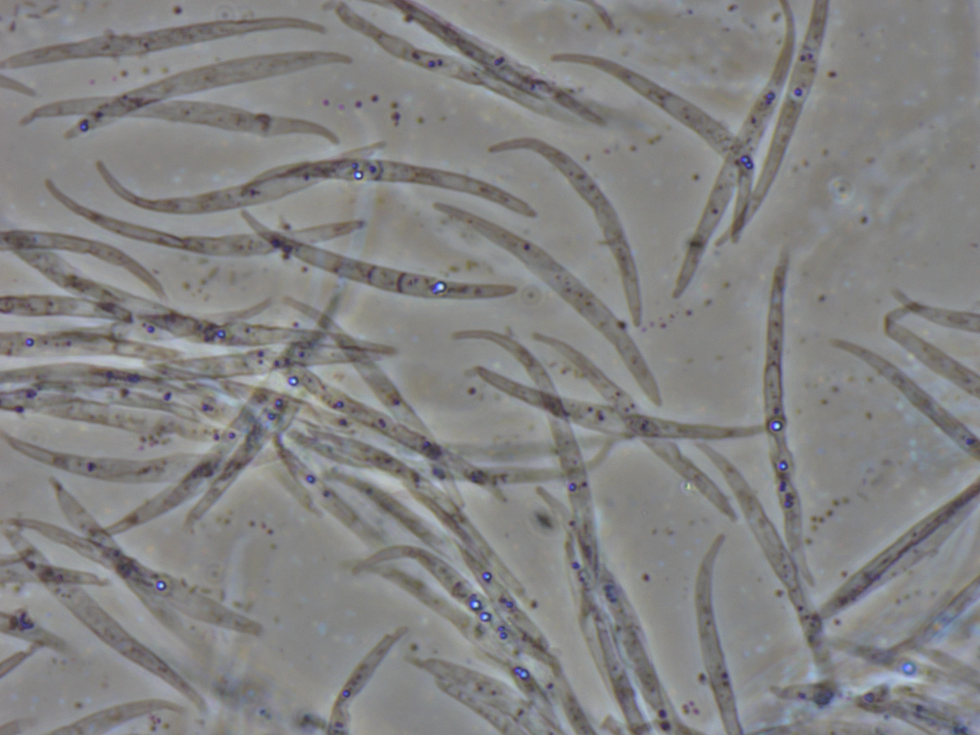 : Fusarium tricinctum.