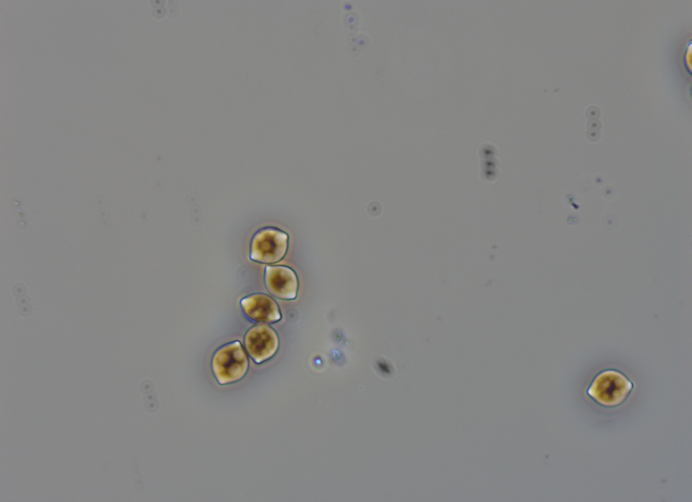 : Chaetomium hungaricum.