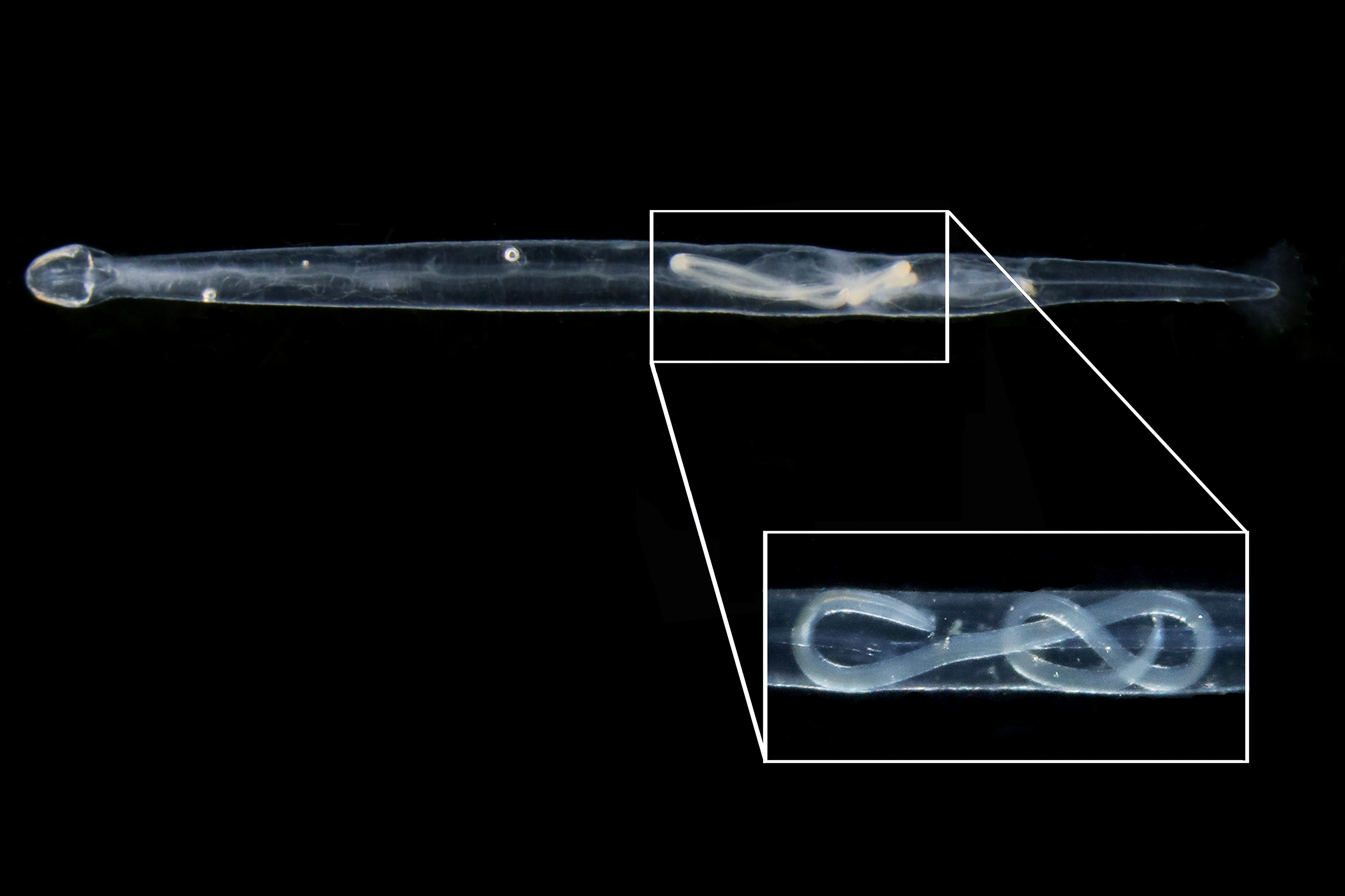 : Trematoda. : Chaetognatha.