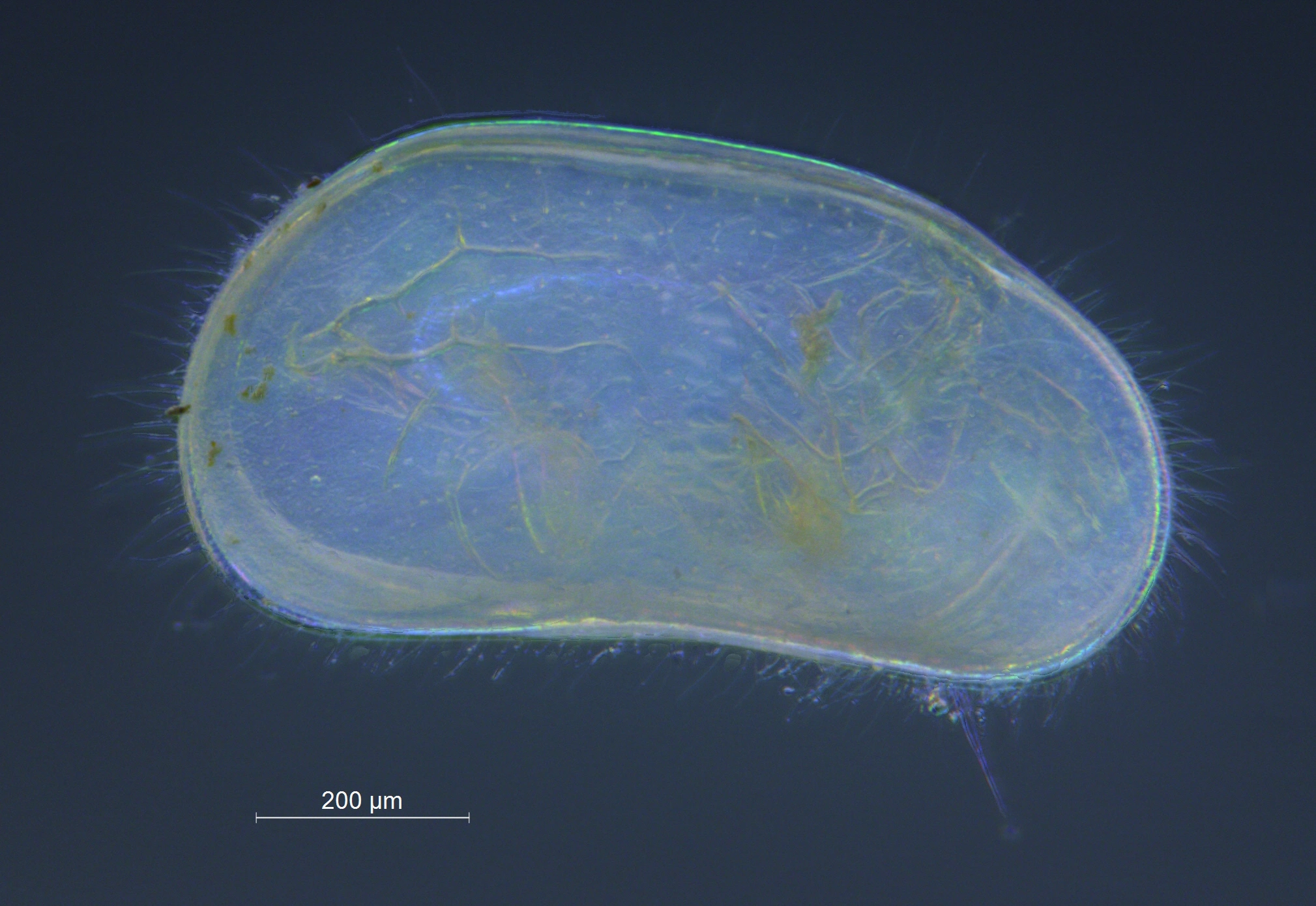 : Pseudocandona rostrata.