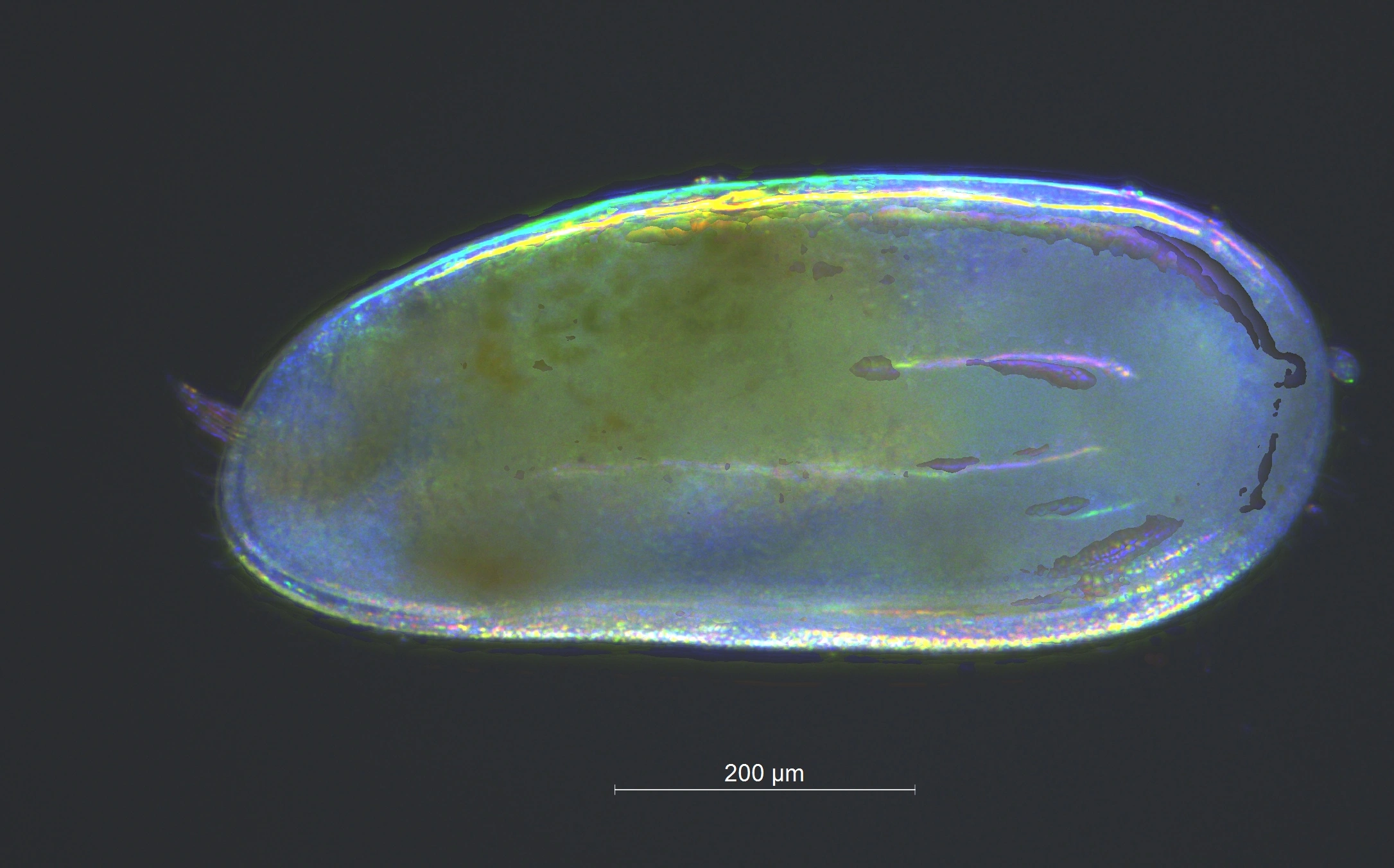 : Darwinula stevensoni.