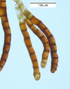 : Encalypta streptocarpa.